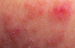 Red looking skin.